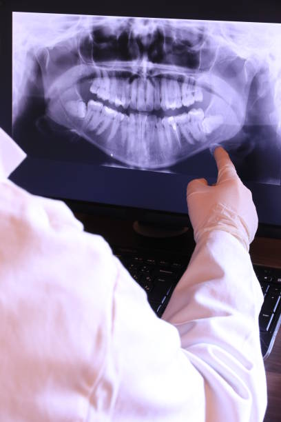 Best Emergency Tooth Extraction in Rockwood, MI