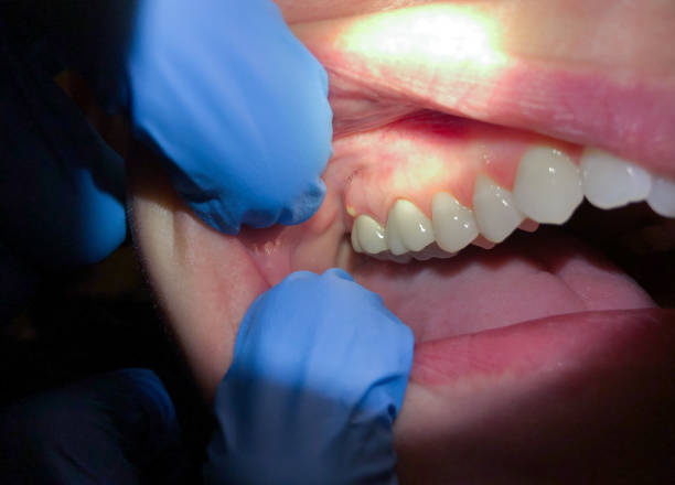 Best Emergency Denture Repair in Rockwood, MI