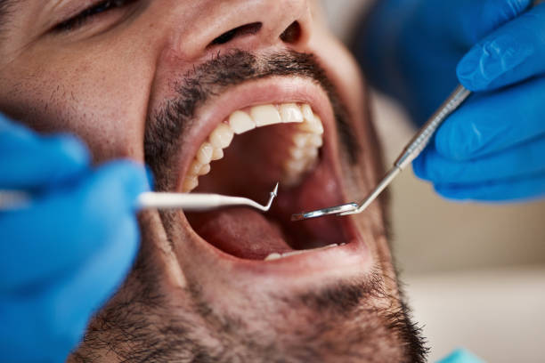 Professional Emergency Dentist in MI