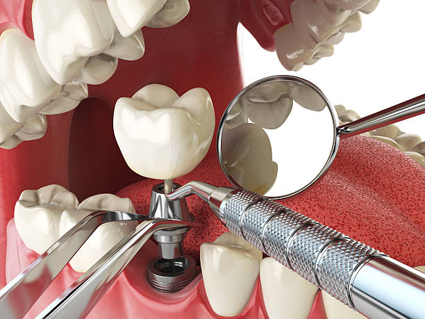 Best Same-Day Emergency Dental Services in Rockwood, MI